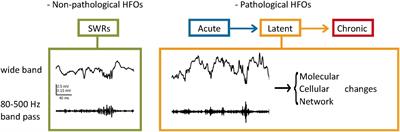 Characterizing Hippocampal Oscillatory Signatures Underlying Seizures in Temporal Lobe Epilepsy